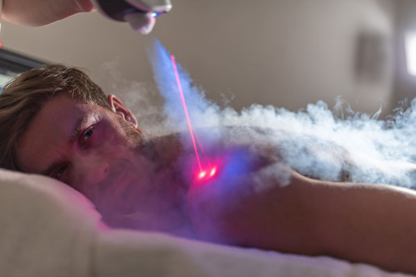 cryotherapy session